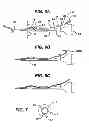 Fig. 06 - Anchor driver with suture clutch
