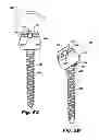 Fig. 09 - System and method for performing spinal surgery