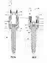 Fig. 09 - Uni-planer bone fixation assembly