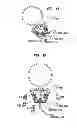 Fig. 08 - IMPLANTABLE DEVICE MIGRATION CONTROL