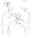 Fig. 01 - Effective capture test