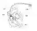 Fig. 01 - Methods and apparatus to stimulate heart atria