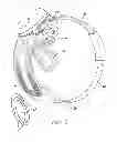 Fig. 10 - Multi-electrode integration in a visual prosthesis