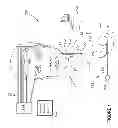 Fig. 02 - Microburst electrical stimulation of cranial nerves for the treatment of medical conditions