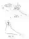 Fig. 04 - Minimally invasive implantable neurostimulation system