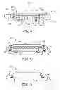Fig. 05 - Minimally invasive implantable neurostimulation system