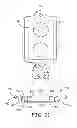 Fig. 15 - Minimally invasive implantable neurostimulation system