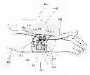 Fig. 01 - Method and system for blocking nerve conduction