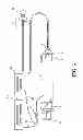 Fig. 04 - METHOD FOR TREATING AND REPAIRING MITRAL VALVE ANNULUS