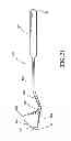 Fig. 22 - METHOD FOR TREATING AND REPAIRING MITRAL VALVE ANNULUS