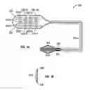 Fig. 02 - METHOD FOR PROCESSING ELECTRODES FOR STIMULATION LEAD