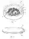 Fig. 07 - Implantable package to facilitate inspection