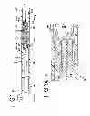 Fig. 02 - Stent delivery system with threaded engagement method