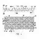 Fig. 07 - Intravascular stent