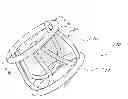 Fig. 01 - STENTLESS AORTIC VALVE REPLACEMENT WITH HIGH RADIAL STRENGTH