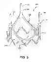 Fig. 04 - LEAFLET AND VALVE APPARATUS