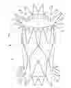 Fig. 01 - Transcatheter heart valves