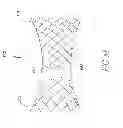 Fig. 32 - Transcatheter heart valves