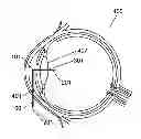 Fig. 01 - Apparatus And Method For The Treatment of Cataract