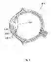 Fig. 06 - Apparatus And Method For The Treatment of Cataract