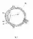 Fig. 08 - Apparatus And Method For The Treatment of Cataract