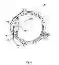 Fig. 09 - Apparatus And Method For The Treatment of Cataract