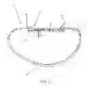 Fig. 02 - Valve assemblies for implantable prostheses and tissue expanders