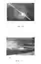 Fig. 07 - Valve assemblies for implantable prostheses and tissue expanders