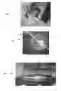 Fig. 08 - Valve assemblies for implantable prostheses and tissue expanders