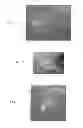 Fig. 09 - Valve assemblies for implantable prostheses and tissue expanders