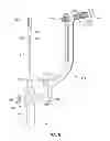 Fig. 09 - Apparatus and method for reconstructing a ligament