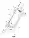 Fig. 28 - Apparatus and method for reconstructing a ligament