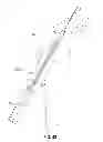 Fig. 41 - Apparatus and method for reconstructing a ligament