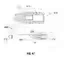 Fig. 46 - Apparatus and method for reconstructing a ligament