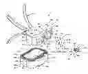 Fig. 01 - Arcuate fixation member