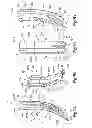 Fig. 08 - Arcuate fixation member