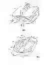 Fig. 02 - Transforaminal prosthetic spinal disc apparatus