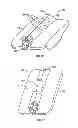 Fig. 06 - Transforaminal prosthetic spinal disc apparatus