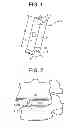 Fig. 02 - Minimally invasive intervertebral staple distraction devices