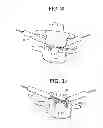 Fig. 08 - Minimally invasive intervertebral staple distraction devices