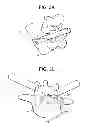 Fig. 09 - Minimally invasive intervertebral staple distraction devices
