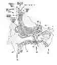 Fig. 02 - Securable implantable component