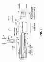 Fig. 02 - Remote actuated valve implant
