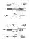 Fig. 09 - Remote actuated valve implant
