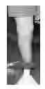 Fig. 01 - Systems and Methods for Modifying Prosthetic Sockets