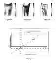 Fig. 07 - Systems and Methods for Modifying Prosthetic Sockets