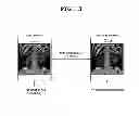 Fig. 04 - REMOTE COLLABORATIVE DIAGNOSIS METHOD AND SYSTEM USING MESSENGER-BASED MEDICAL IMAGE SHARING SCHEME