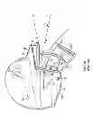 Fig. 04 - Adjustable facial protector
