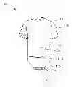 Fig. 01 - ONE-PIECE FEEDING GARMENT