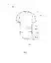 Fig. 02 - ONE-PIECE FEEDING GARMENT